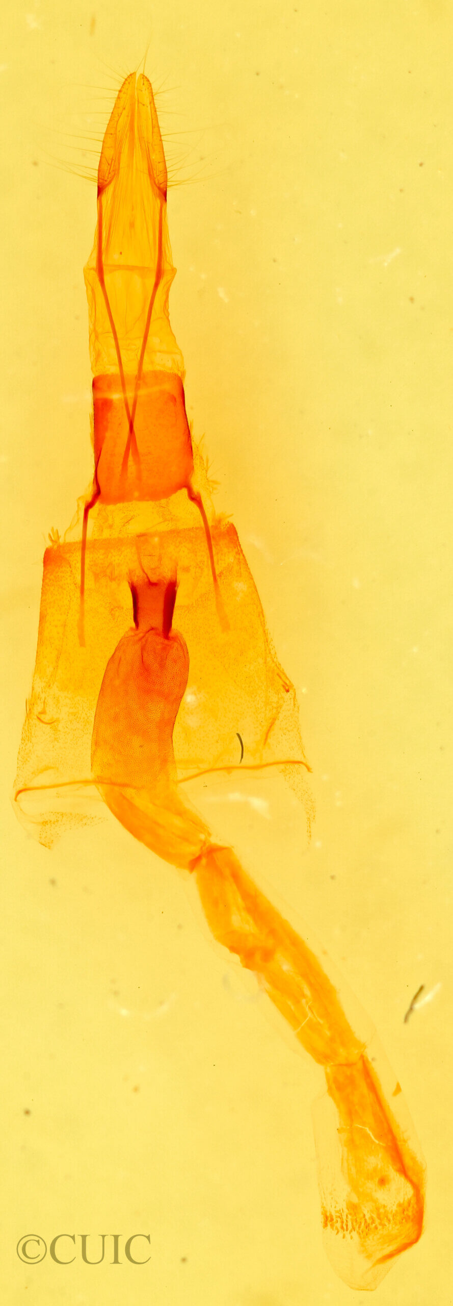 genitalia view of adult Galenara lixaria