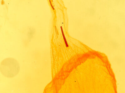 genitalia view of adult Psaphida rolandi