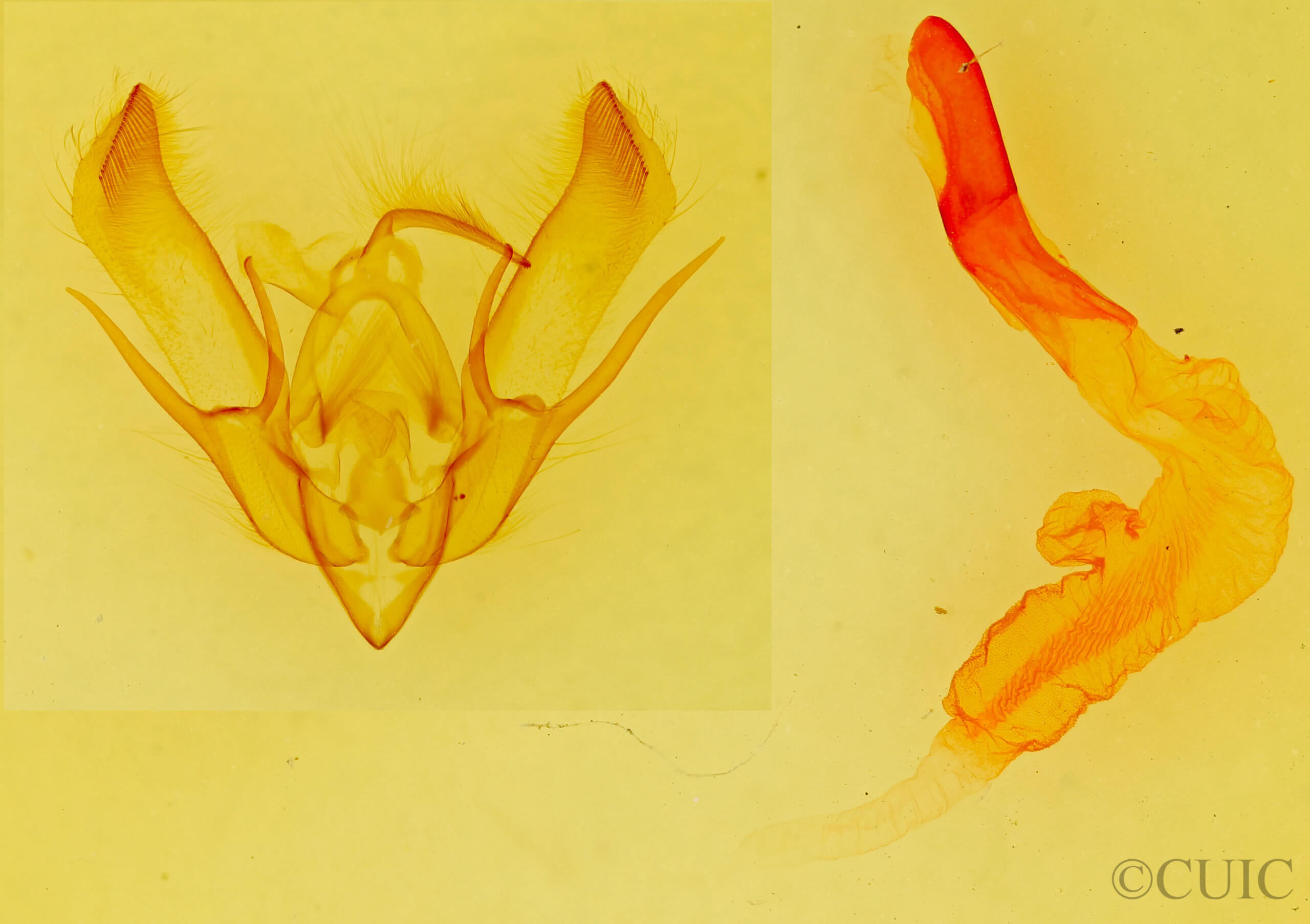 genitalia view of adult Euxoa tessellata