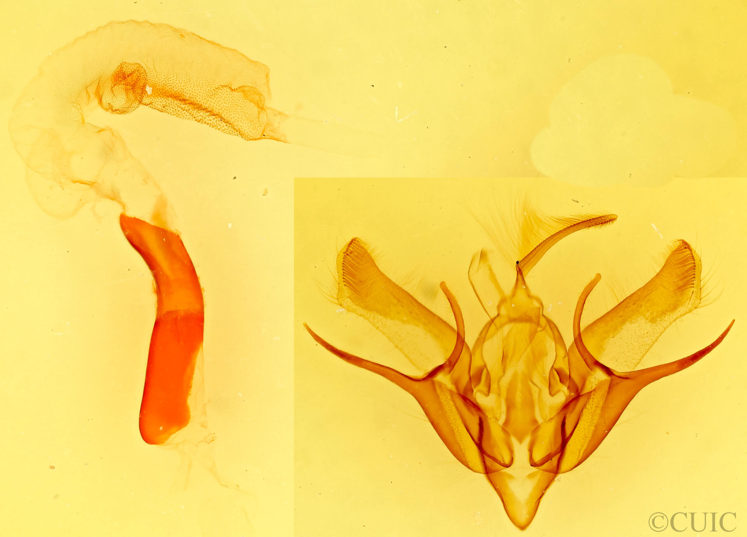 genitalia view of adult Euxoa campestris