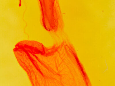 genitalia view of adult Euxoa olivia