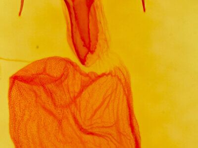 genitalia view of adult Euxoa olivia