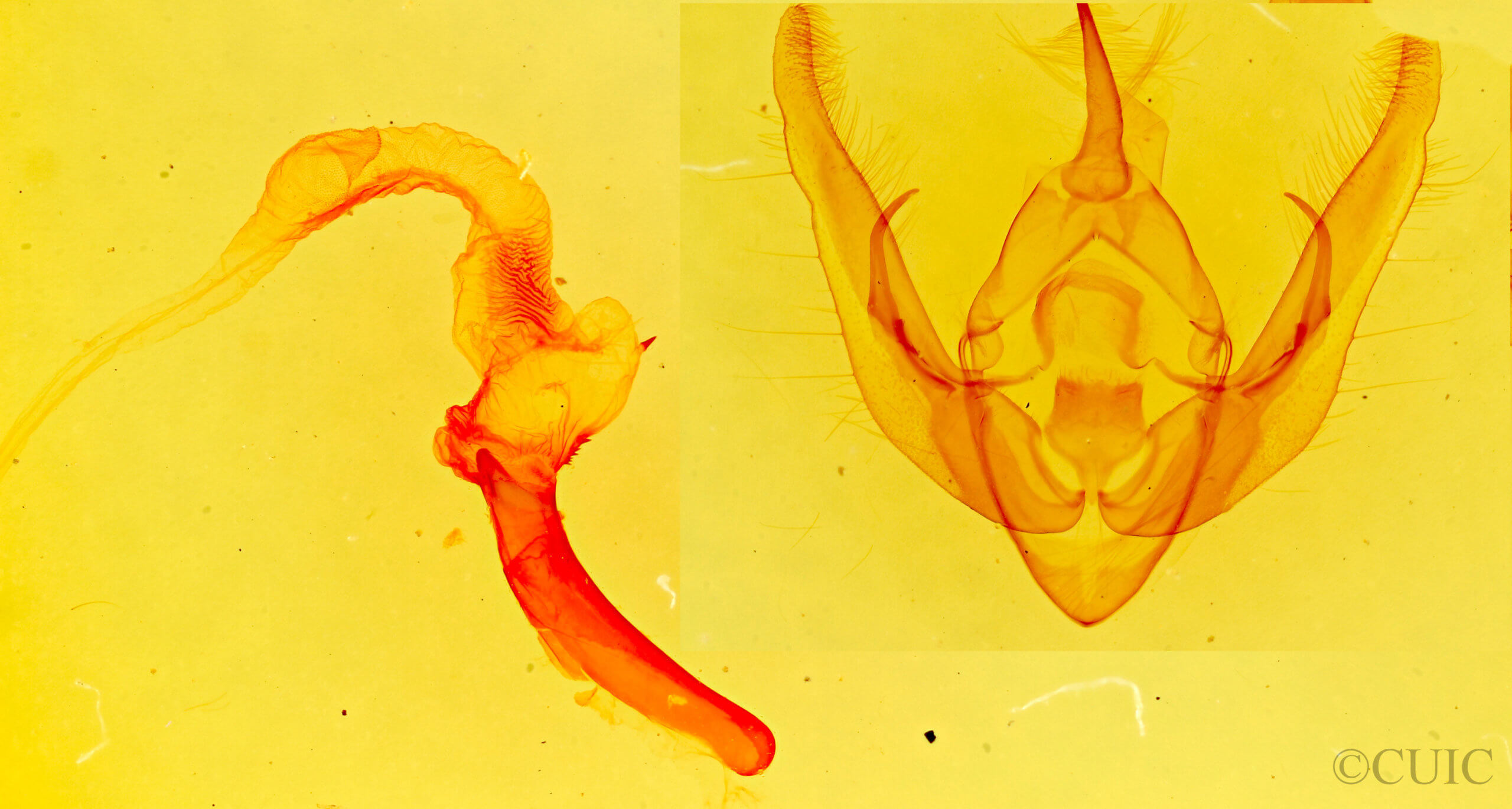 genitalia view of adult Pseudanarta exasperata