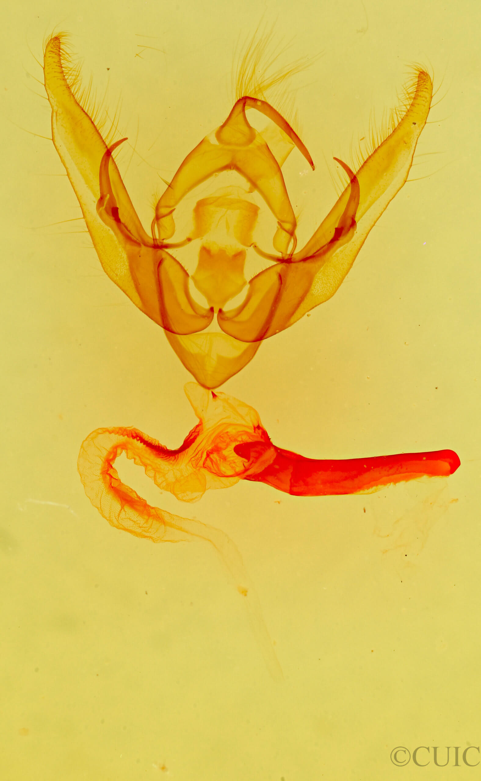 genitalia view of adult Pseudanarta exasperata