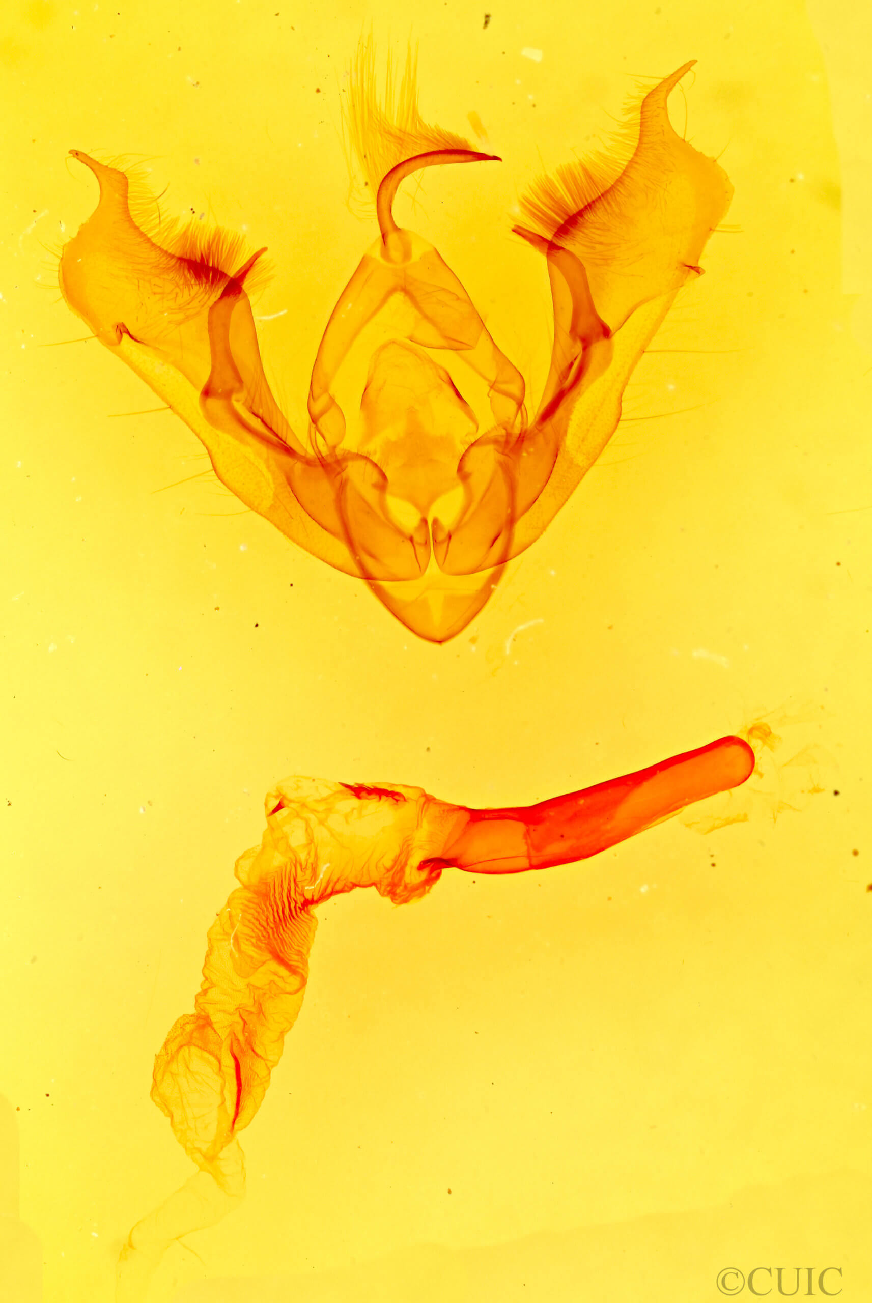 genitalia view of adult Pseudanarta vexata