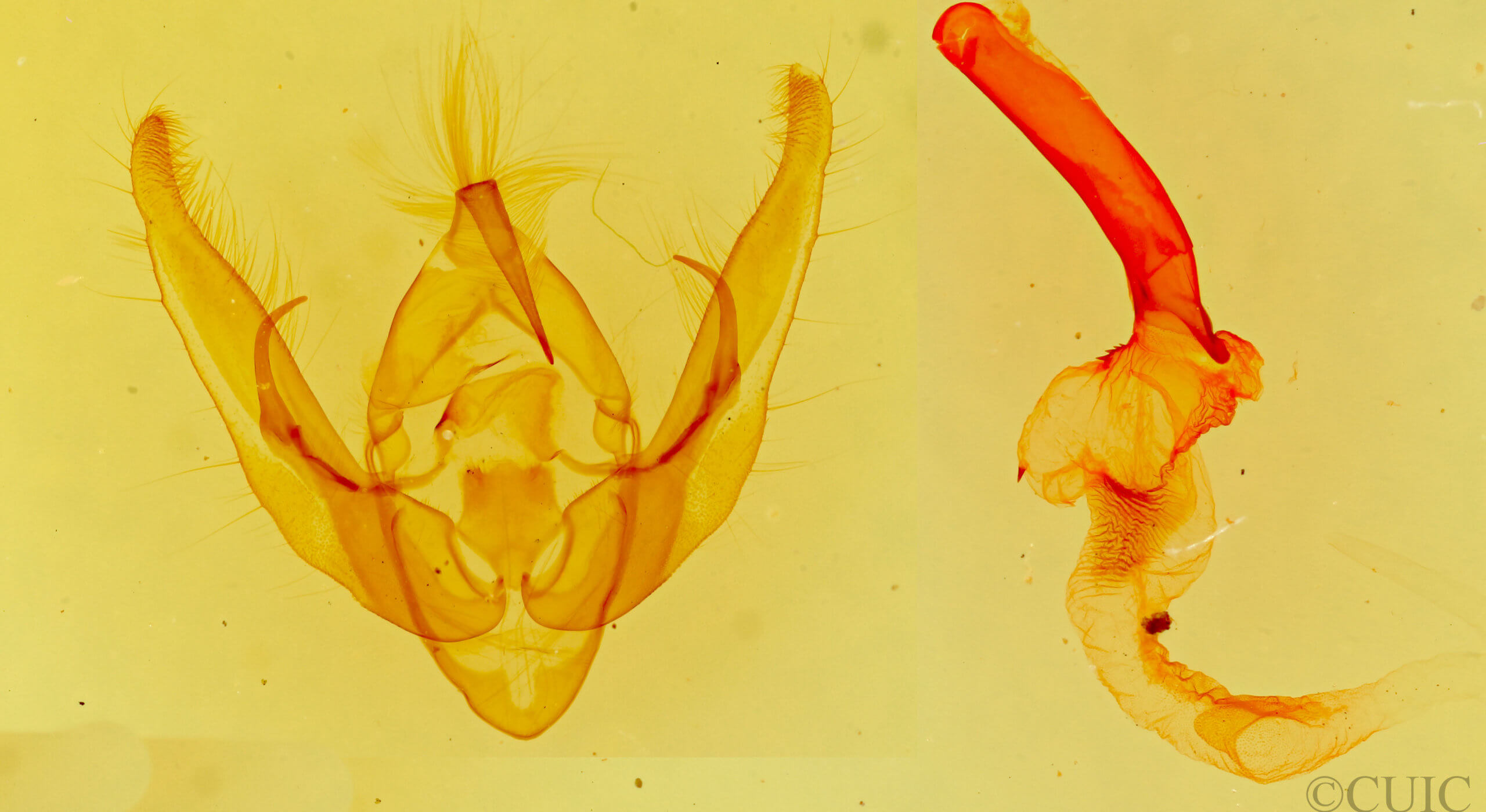 genitalia view of adult Pseudanarta exasperata