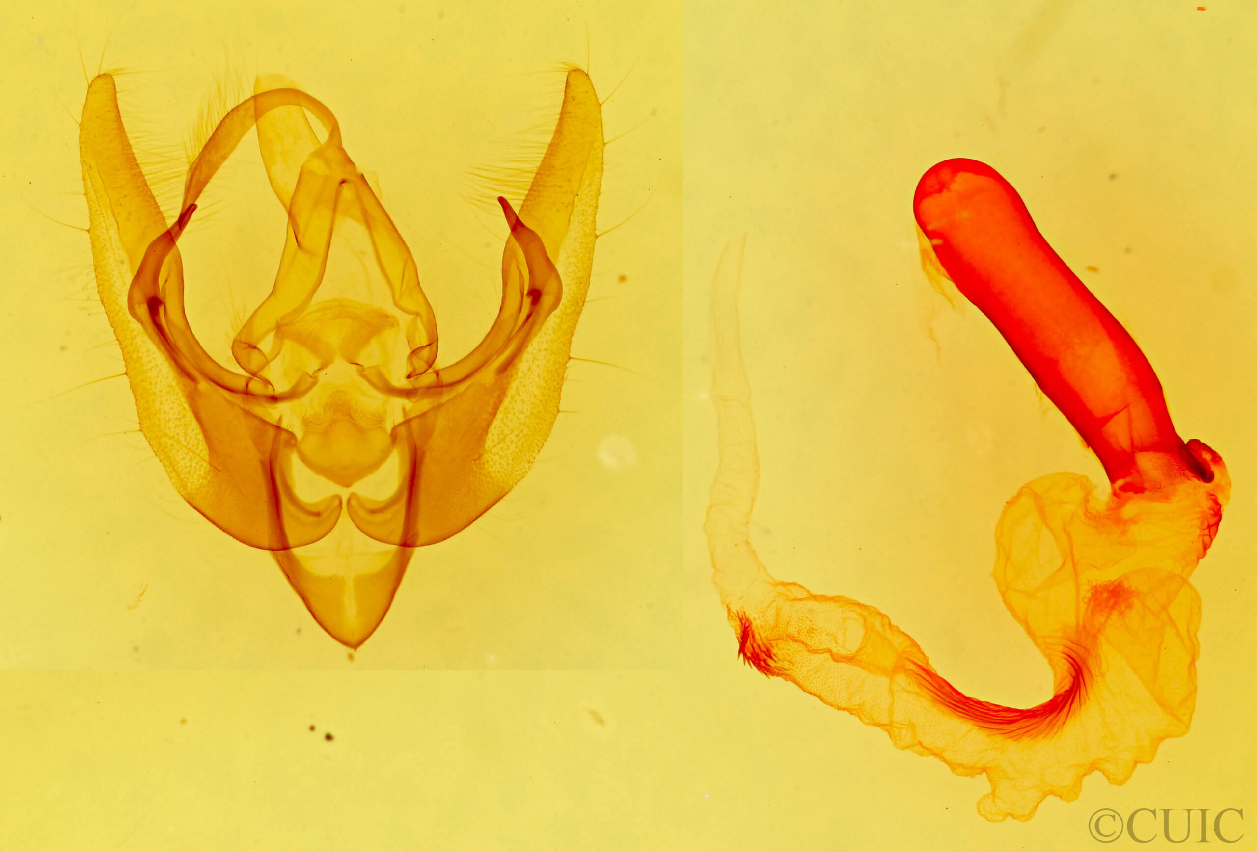 genitalia view of adult Pseudanarta singula
