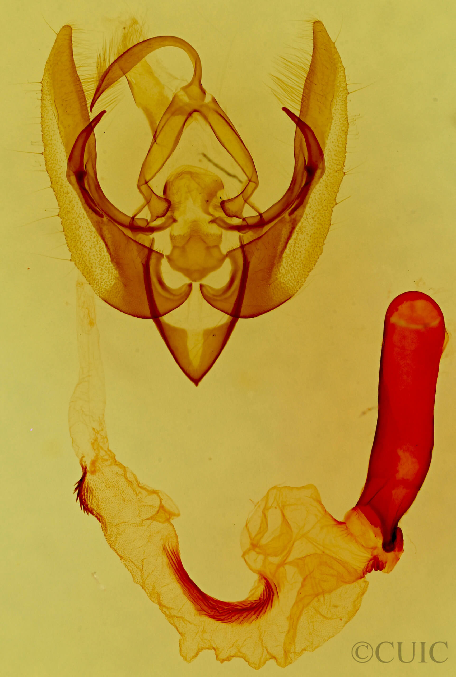 genitalia view of adult Pseudanarta singula