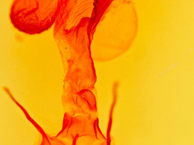 genitalia view of adult Pseudanarta singula