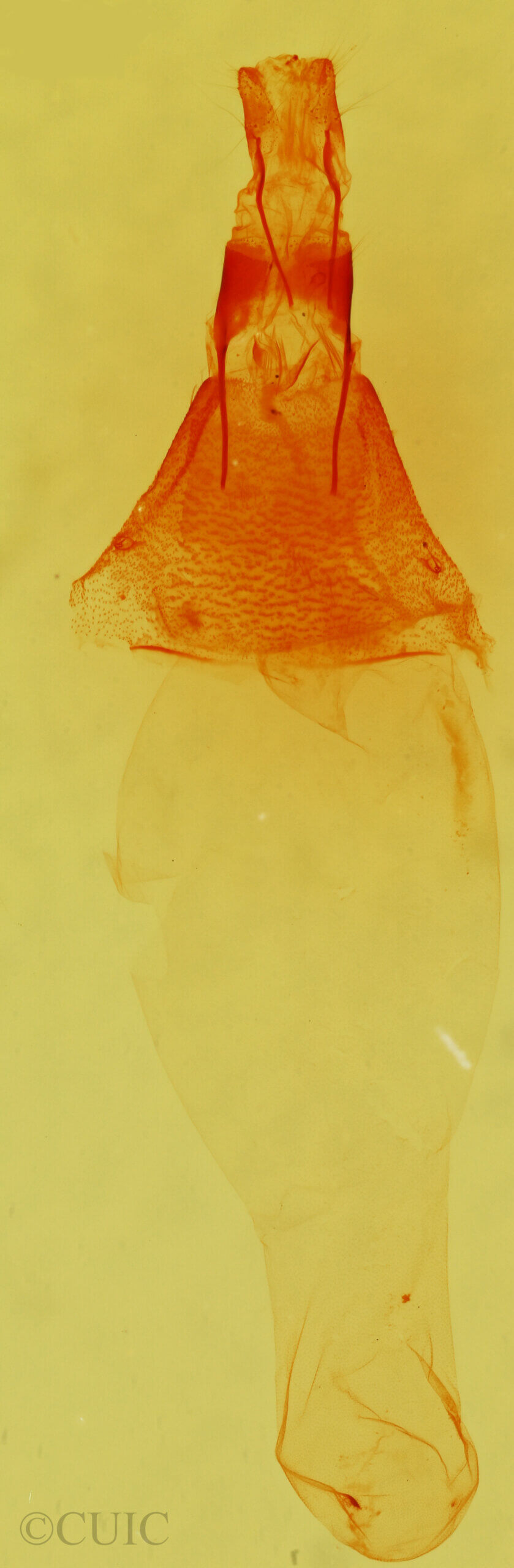 genitalia view of adult Condica egestis