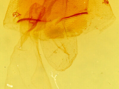 genitalia view of adult Condica temecula