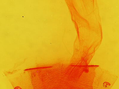 genitalia view of adult Condica charada