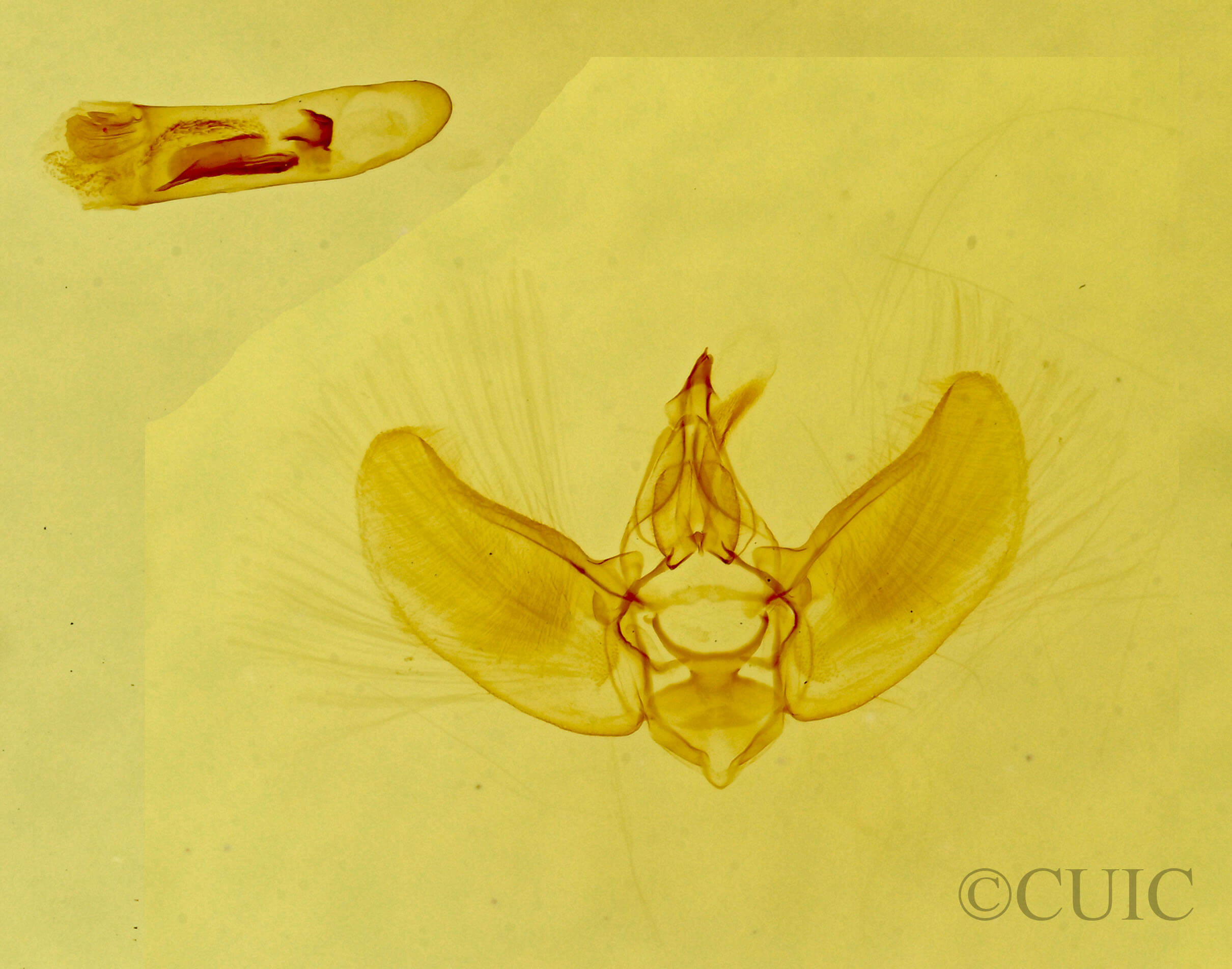 genitalia view of adult Prorella artestata