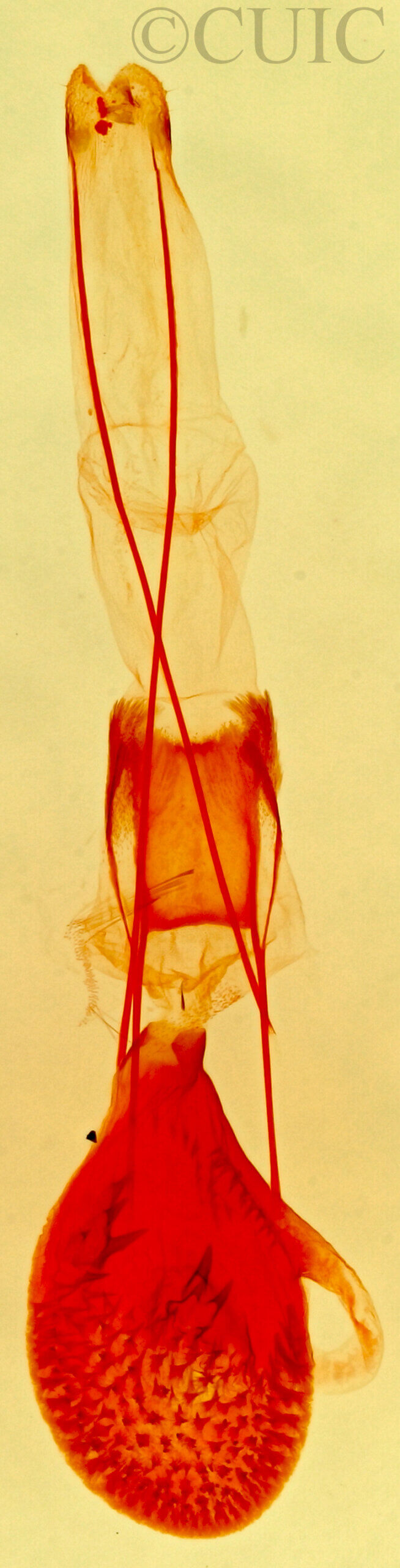 genitalia view of adult Prorella artestata