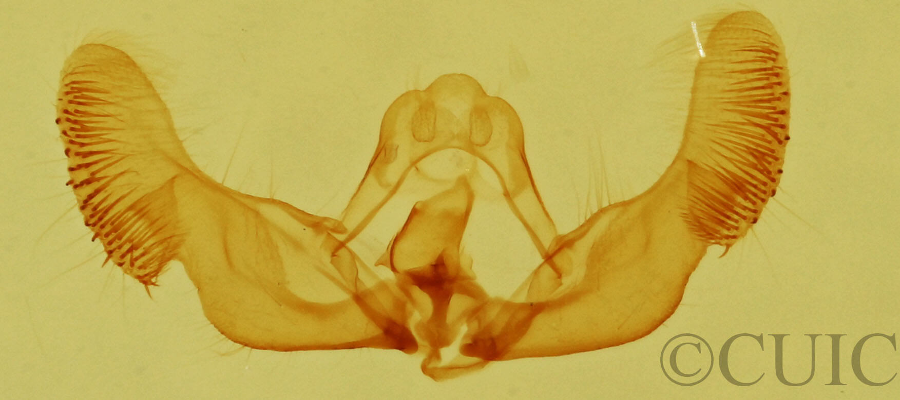 genitalia view of adult Eucopina monitorana