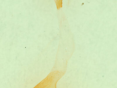 genitalia view of adult Anicla cemolia