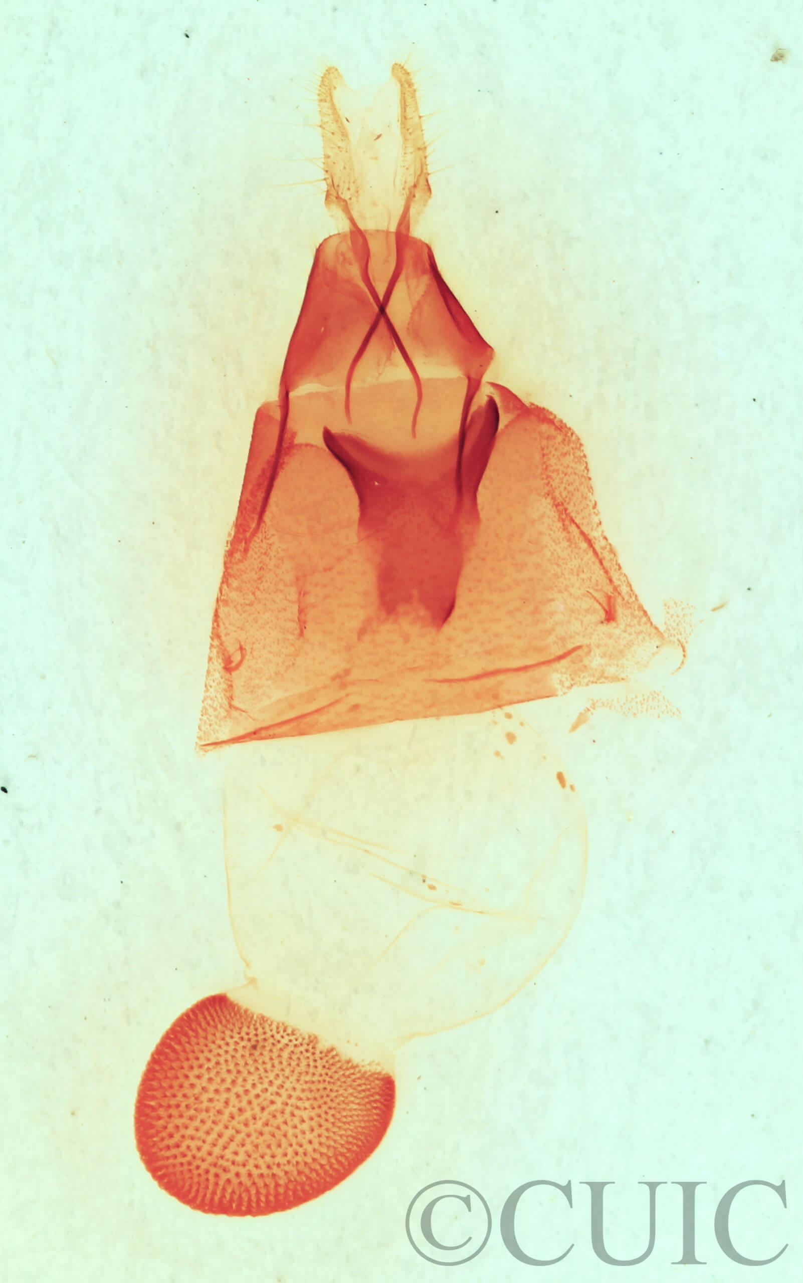 genitalia view of adult Synorthodes auriginea