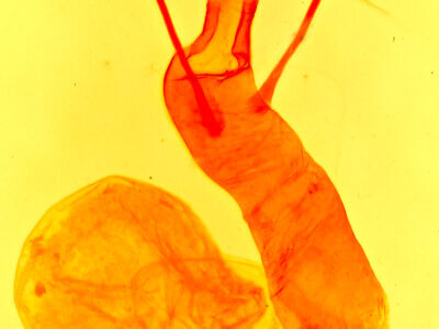 genitalia view of adult Lacinipolia spiculosa