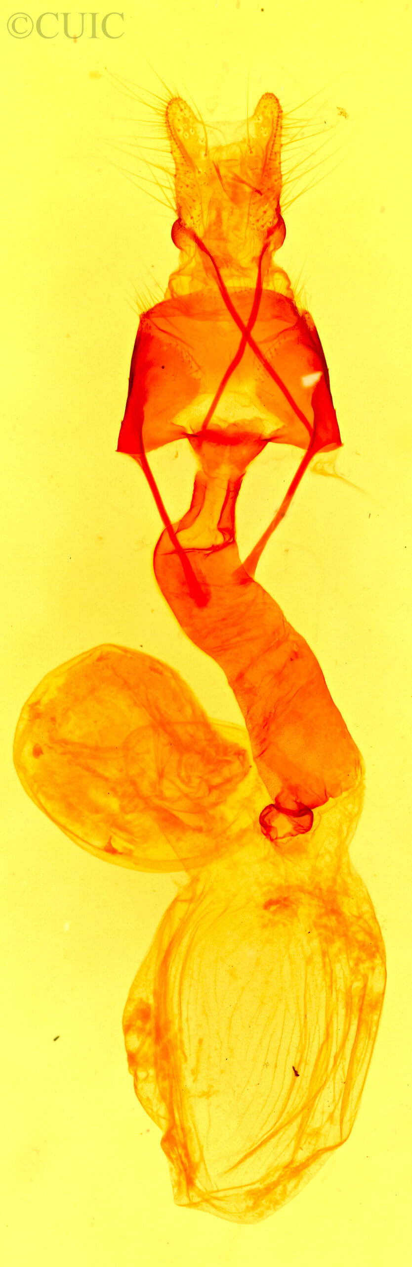 genitalia view of adult Lacinipolia spiculosa