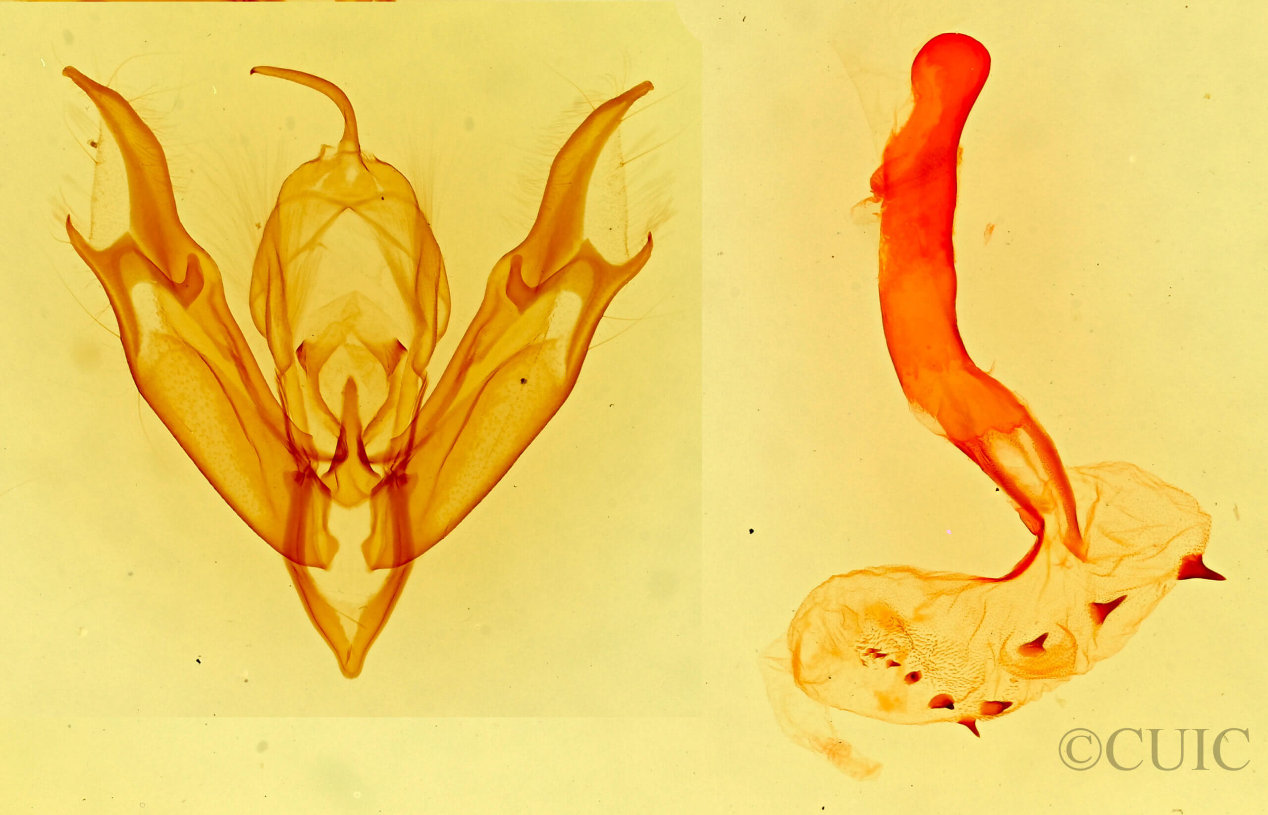 genitalia view of adult Caradrina montana