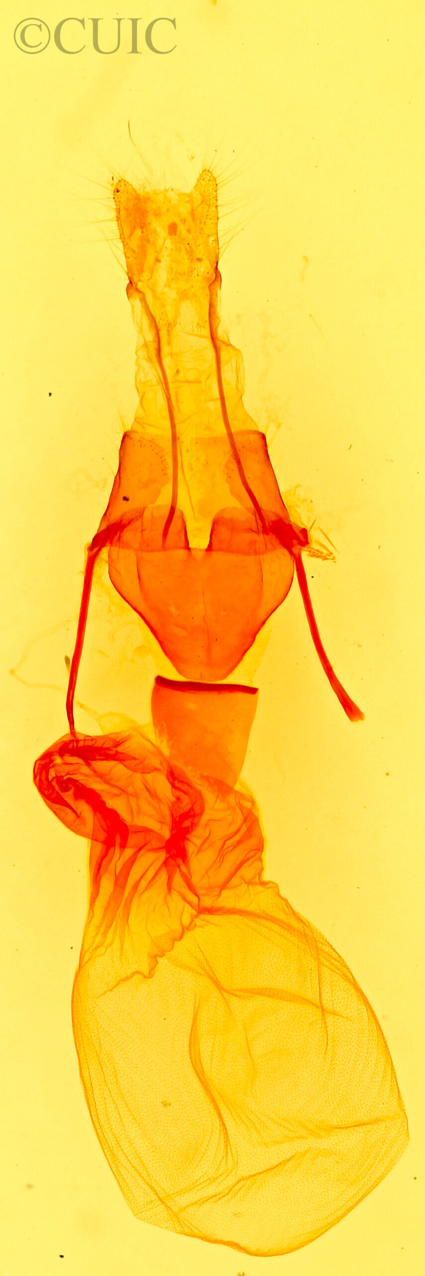 genitalia view of adult Caradrina montana