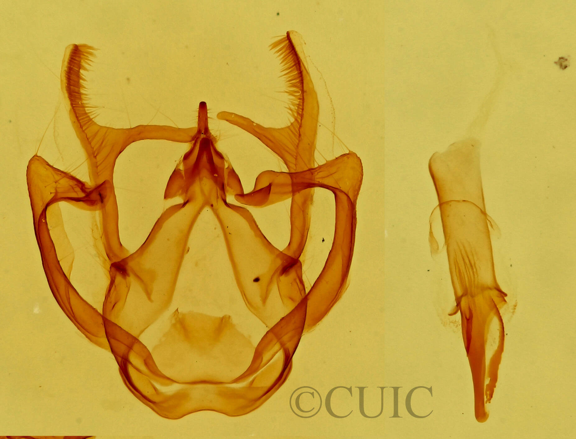genitalia view of adult Rindgea ballandrata