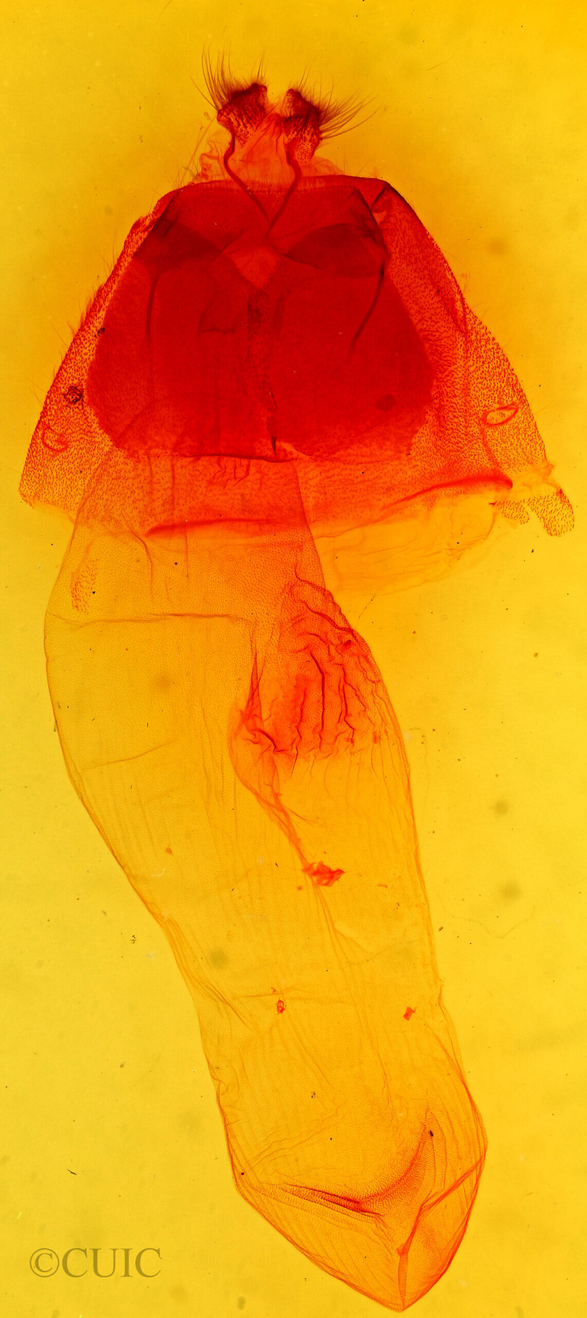 genitalia view of adult Acronicta brumosa liturata
