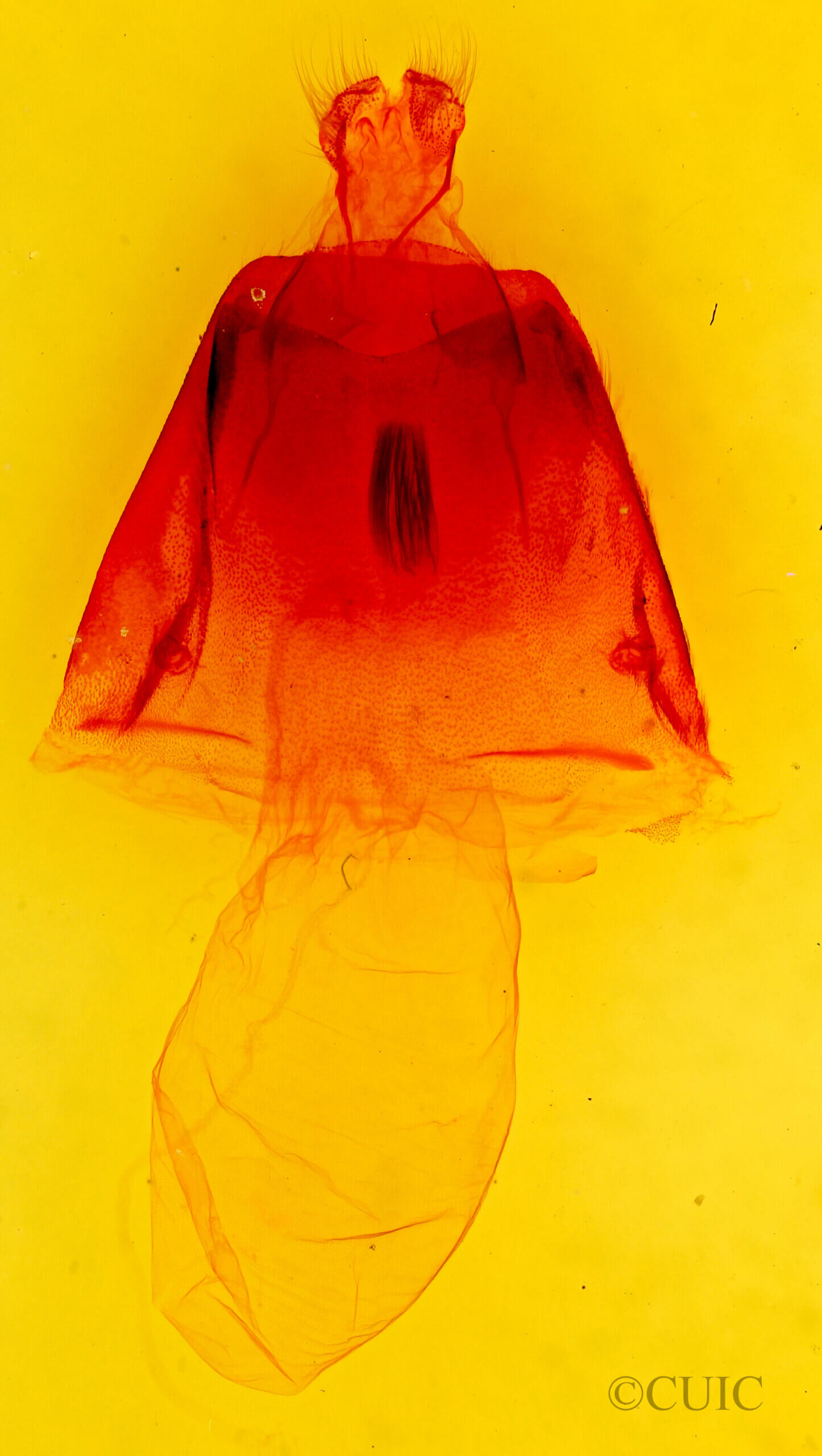 genitalia view of adult Acronicta atristrigatus