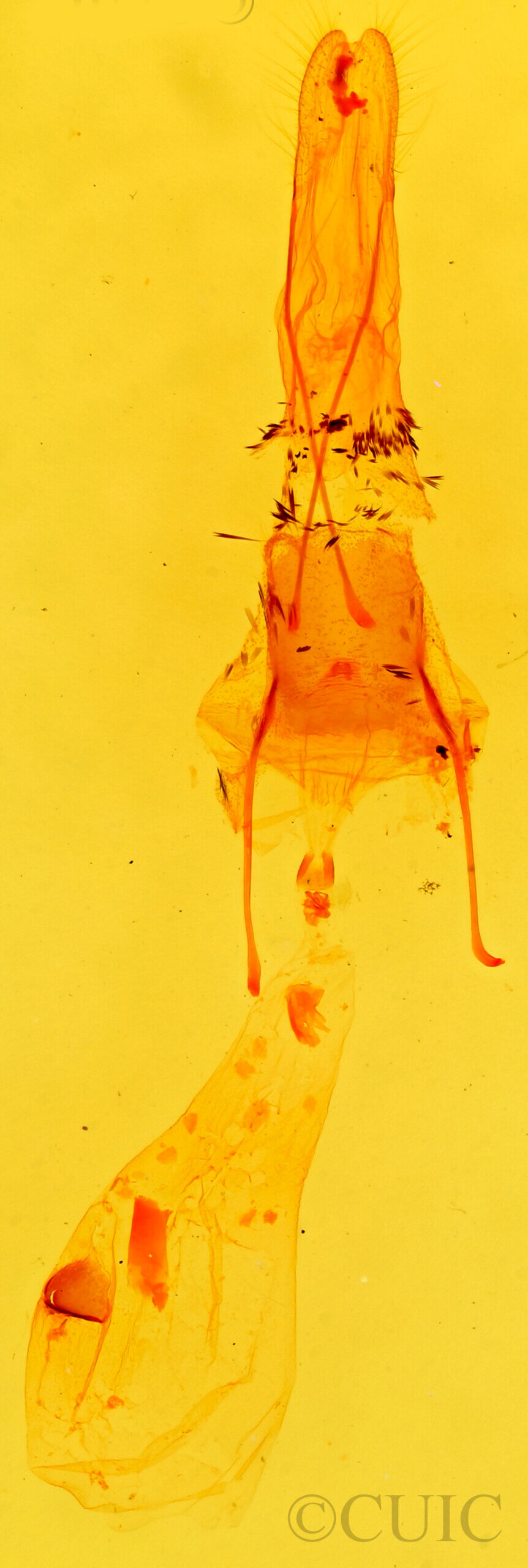 genitalia view of adult Stenoporpia anastomosaria