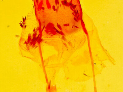 genitalia view of adult Stenoporpia anastomosaria