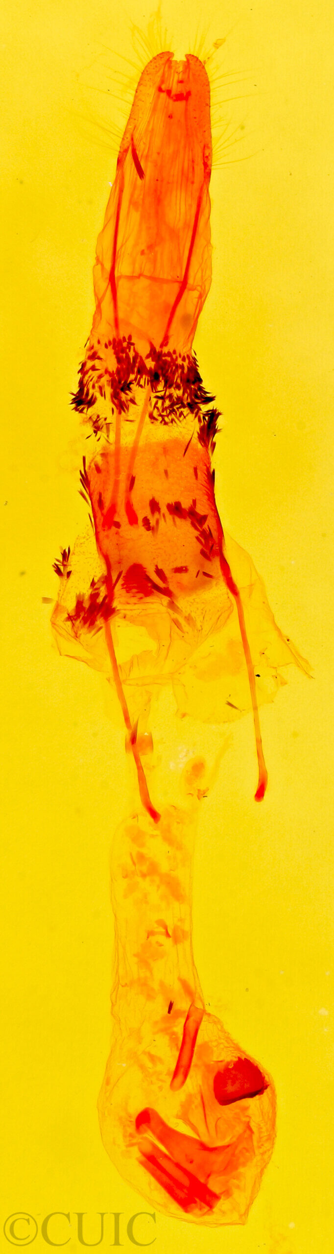 genitalia view of adult Stenoporpia anastomosaria