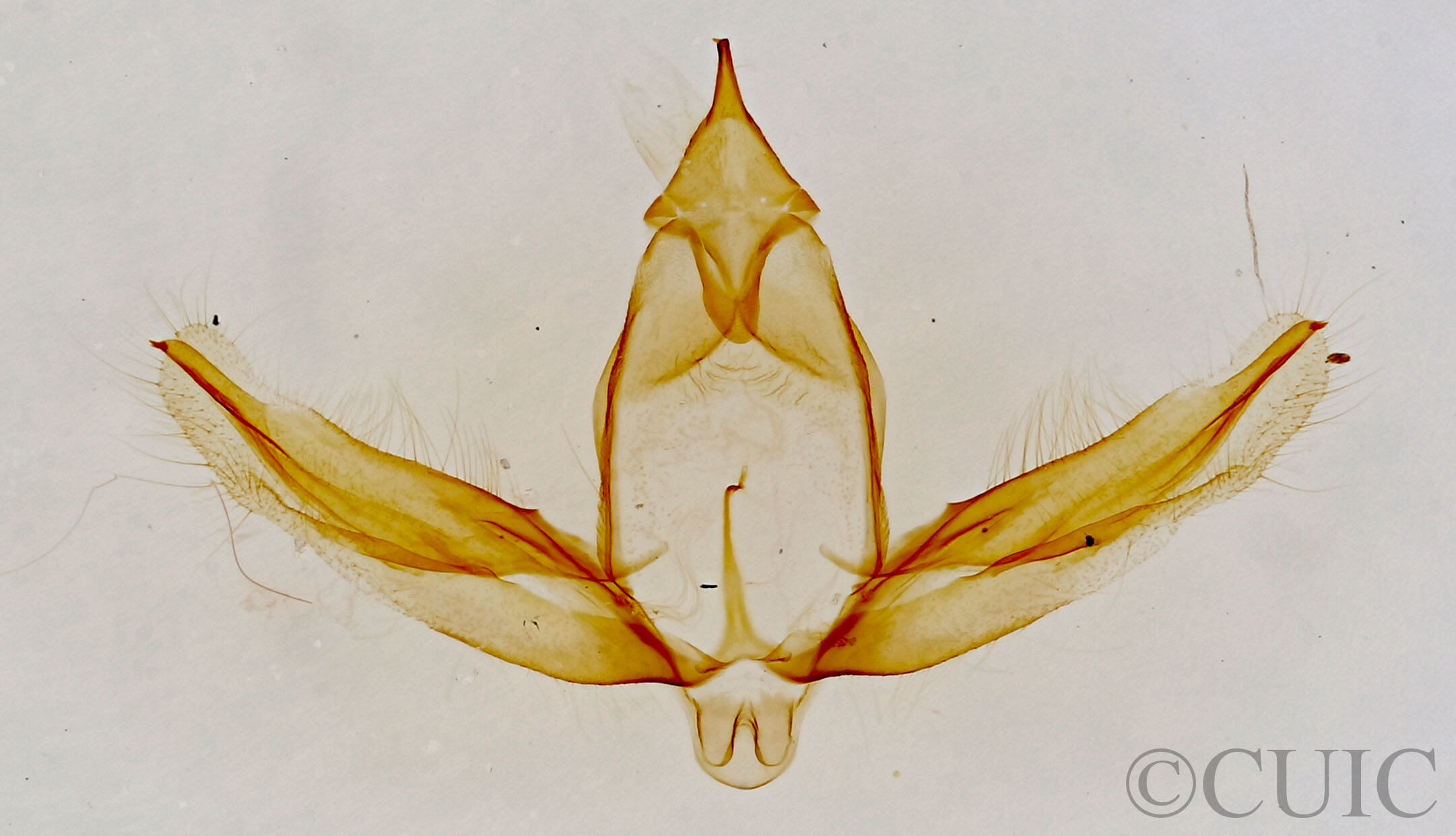 genitalia view of adult Stenoporpia anastomosaria