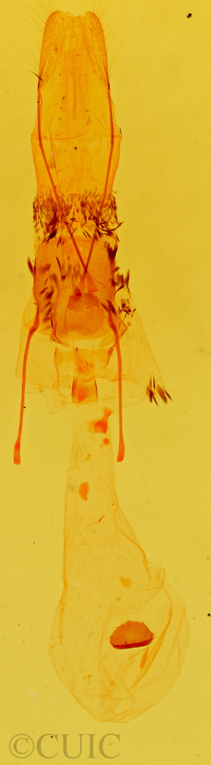 genitalia view of adult Stenoporpia anastomosaria