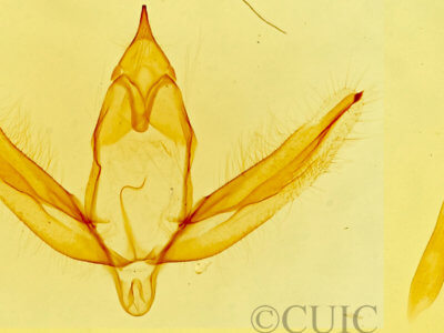 genitalia view of adult Stenoporpia anastomosaria