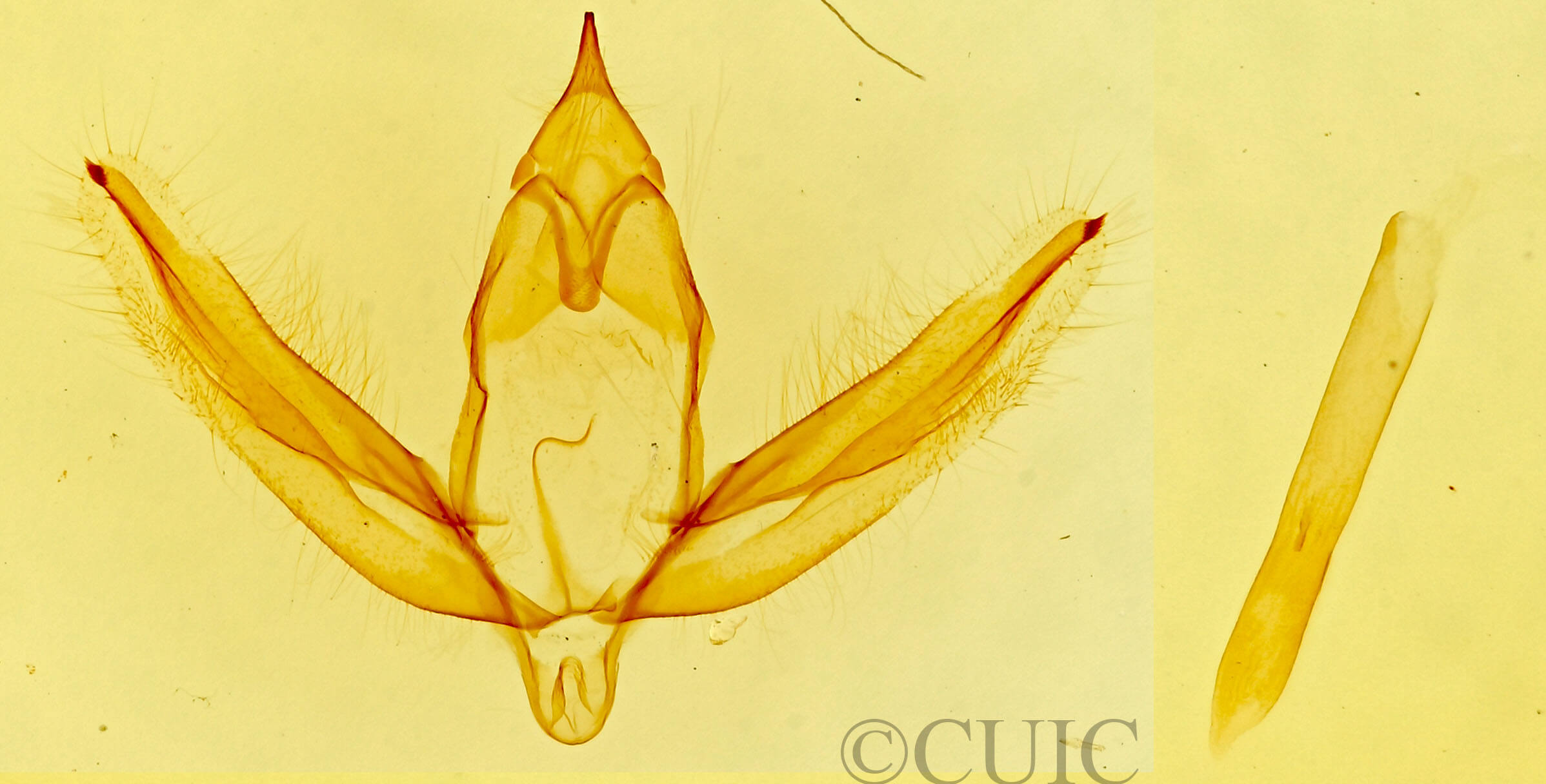 genitalia view of adult Stenoporpia anastomosaria