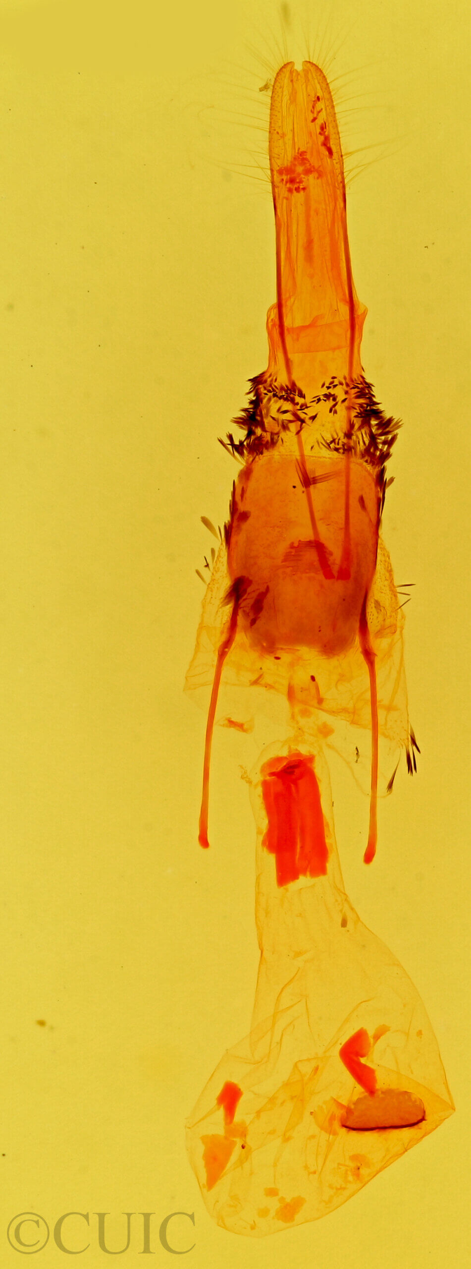 genitalia view of adult Stenoporpia anastomosaria