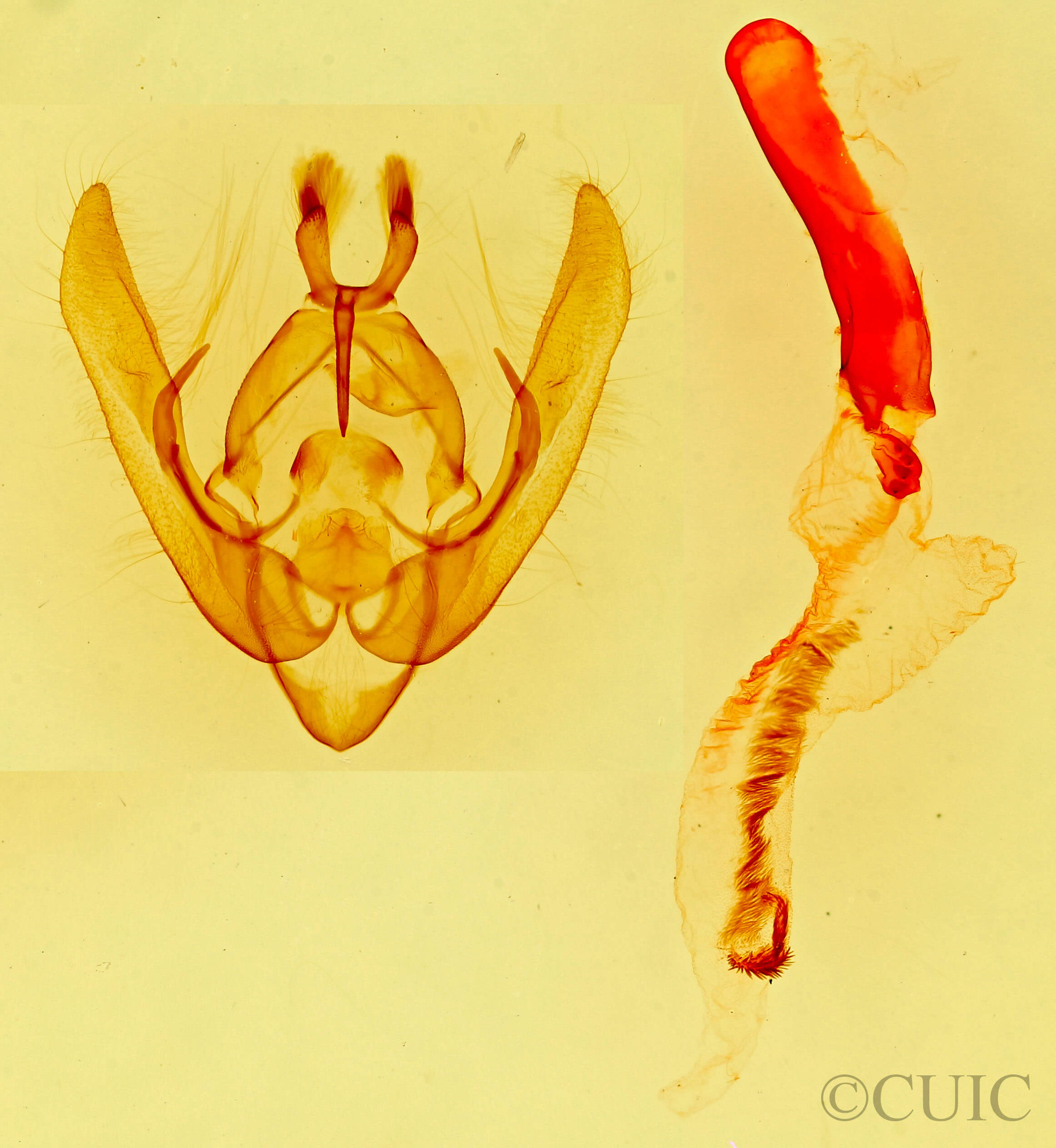 genitalia view of adult Pseudanarta basivirida