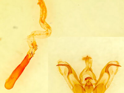 genitalia view of adult Orthosia mediomacula