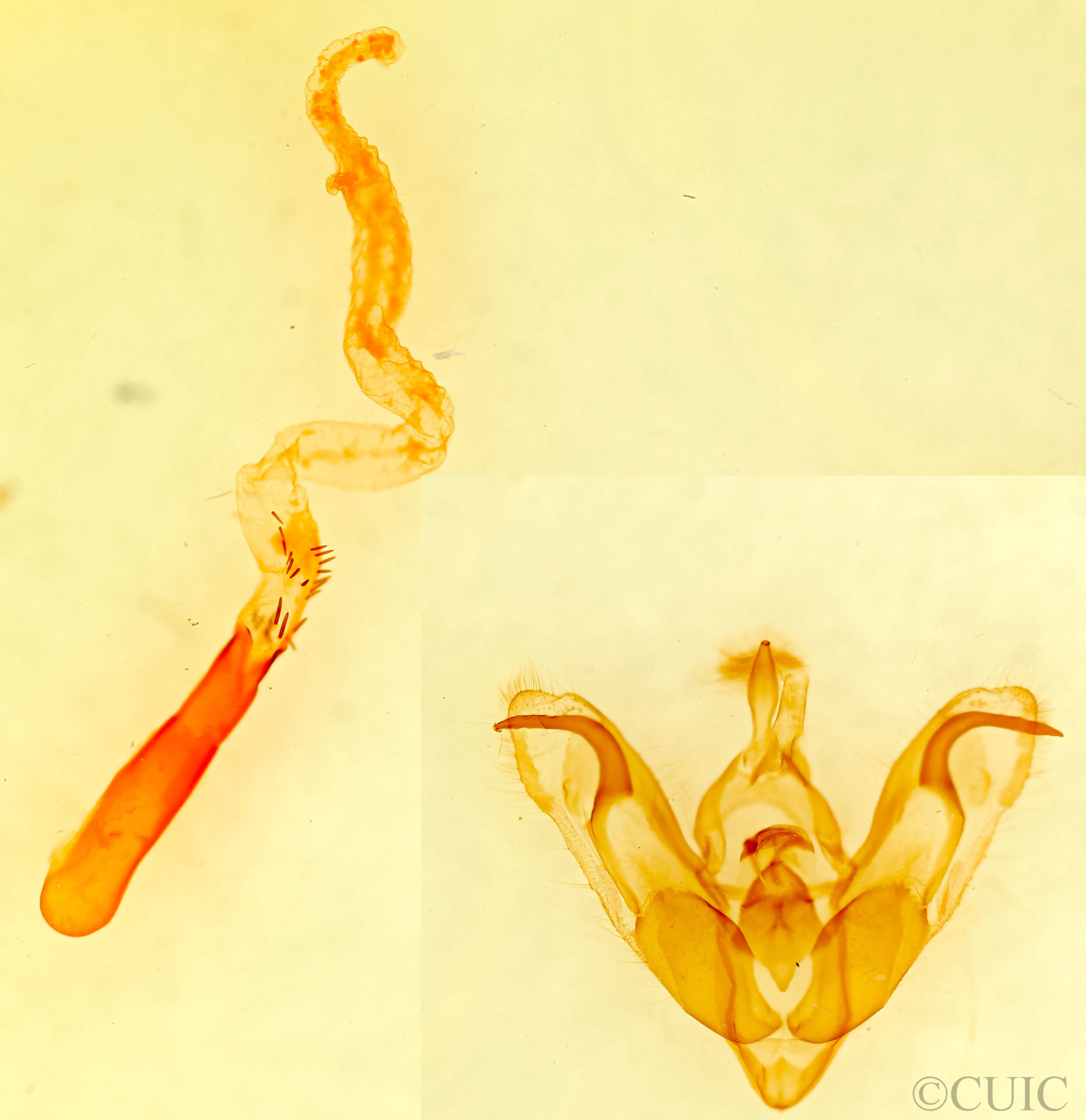 genitalia view of adult Orthosia mediomacula