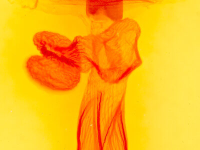 genitalia view of adult Perigonica tertia