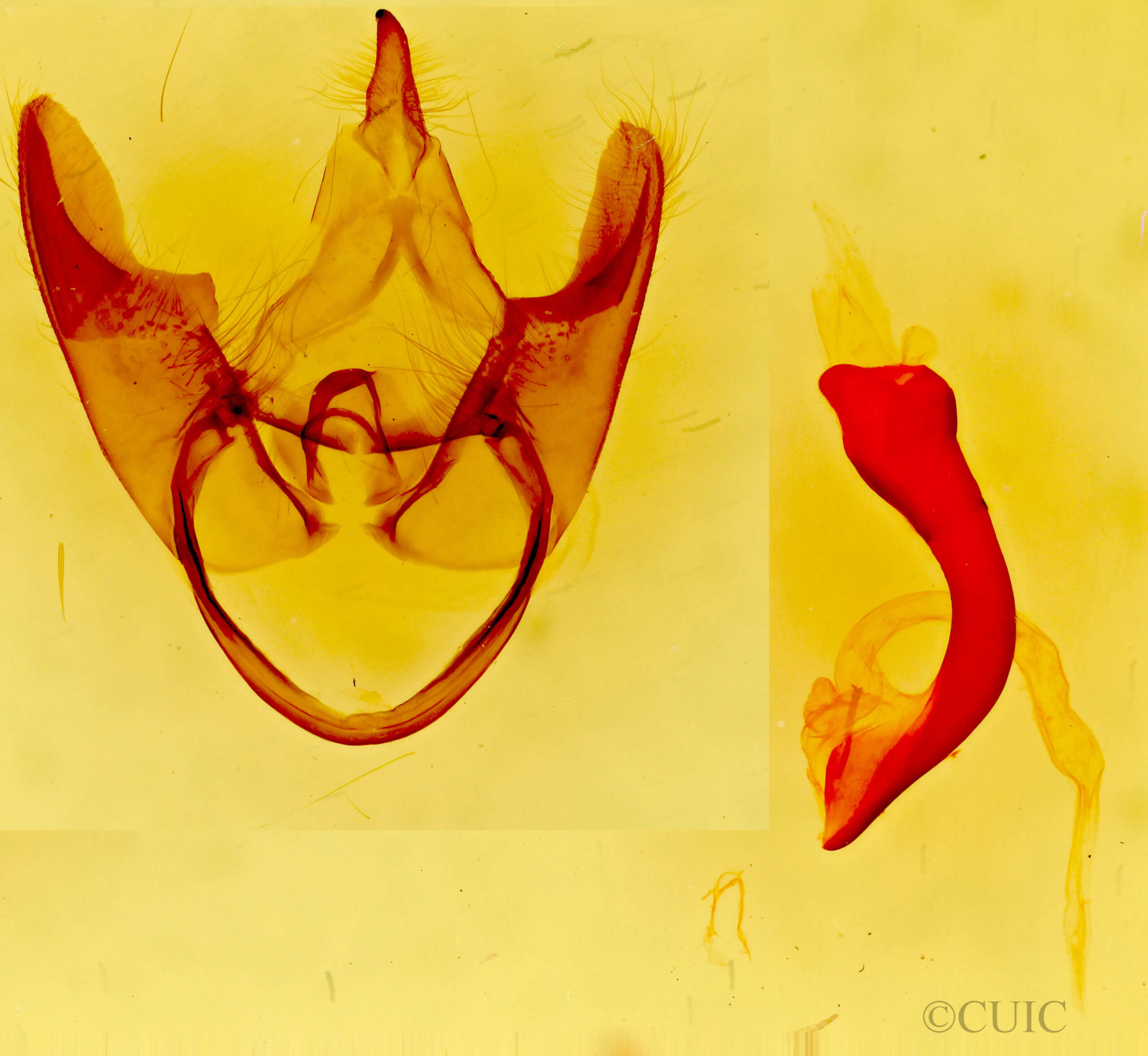 genitalia view of adult Gardinia anopla
