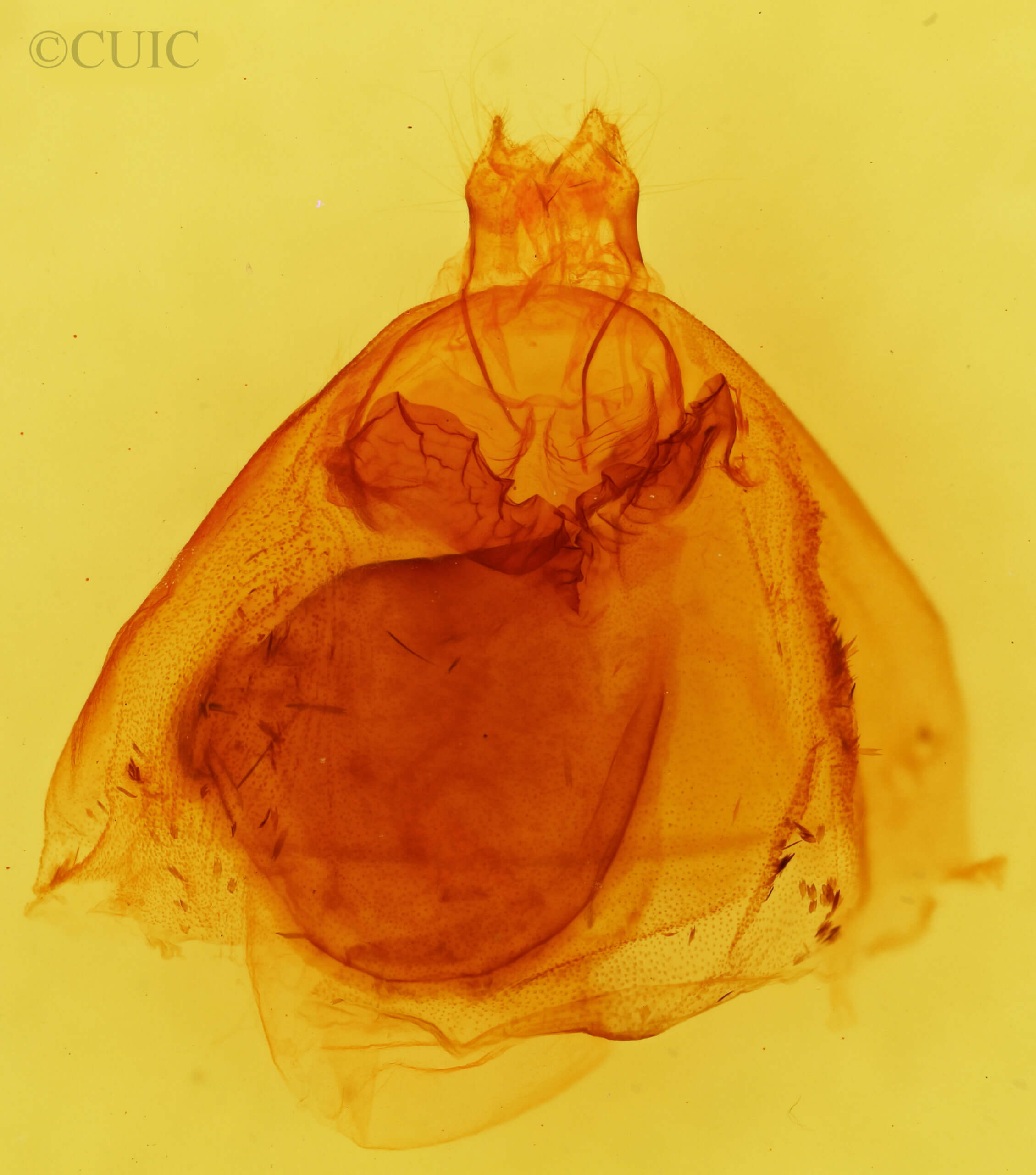 genitalia view of adult Apantesis phalerata