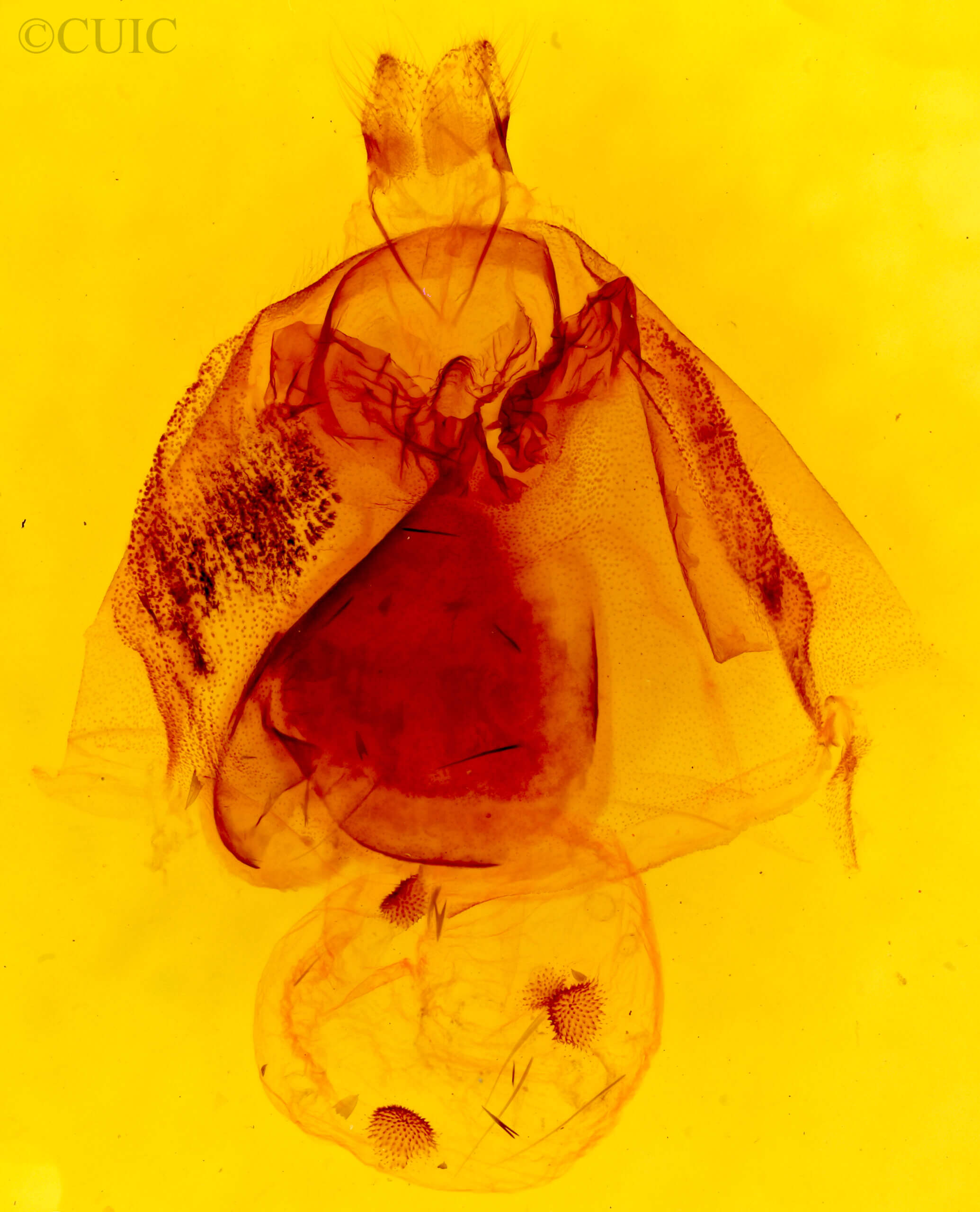 genitalia view of adult Apantesis phalerata