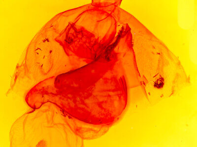 genitalia view of adult Apantesis phalerata