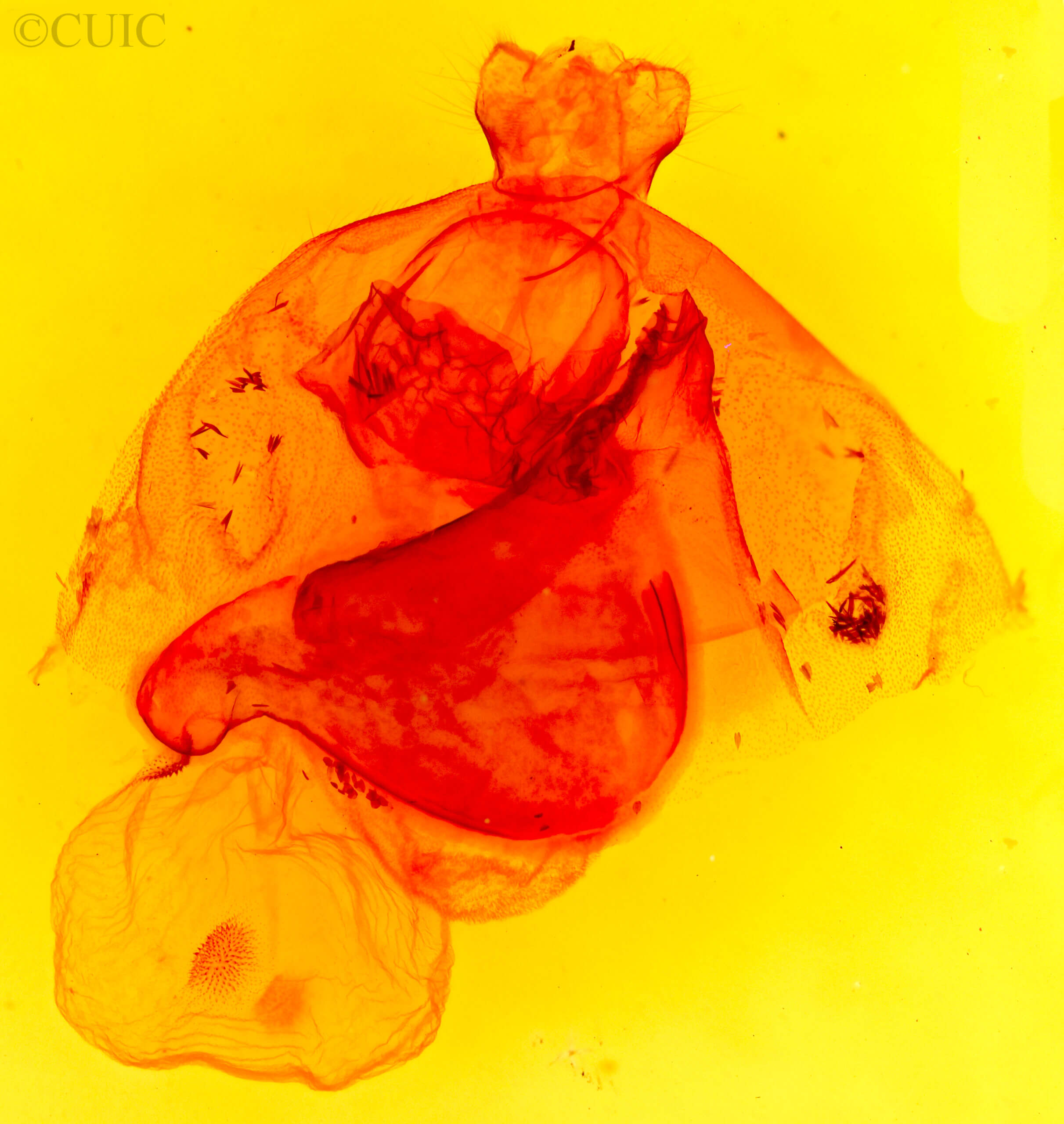 genitalia view of adult Apantesis phalerata