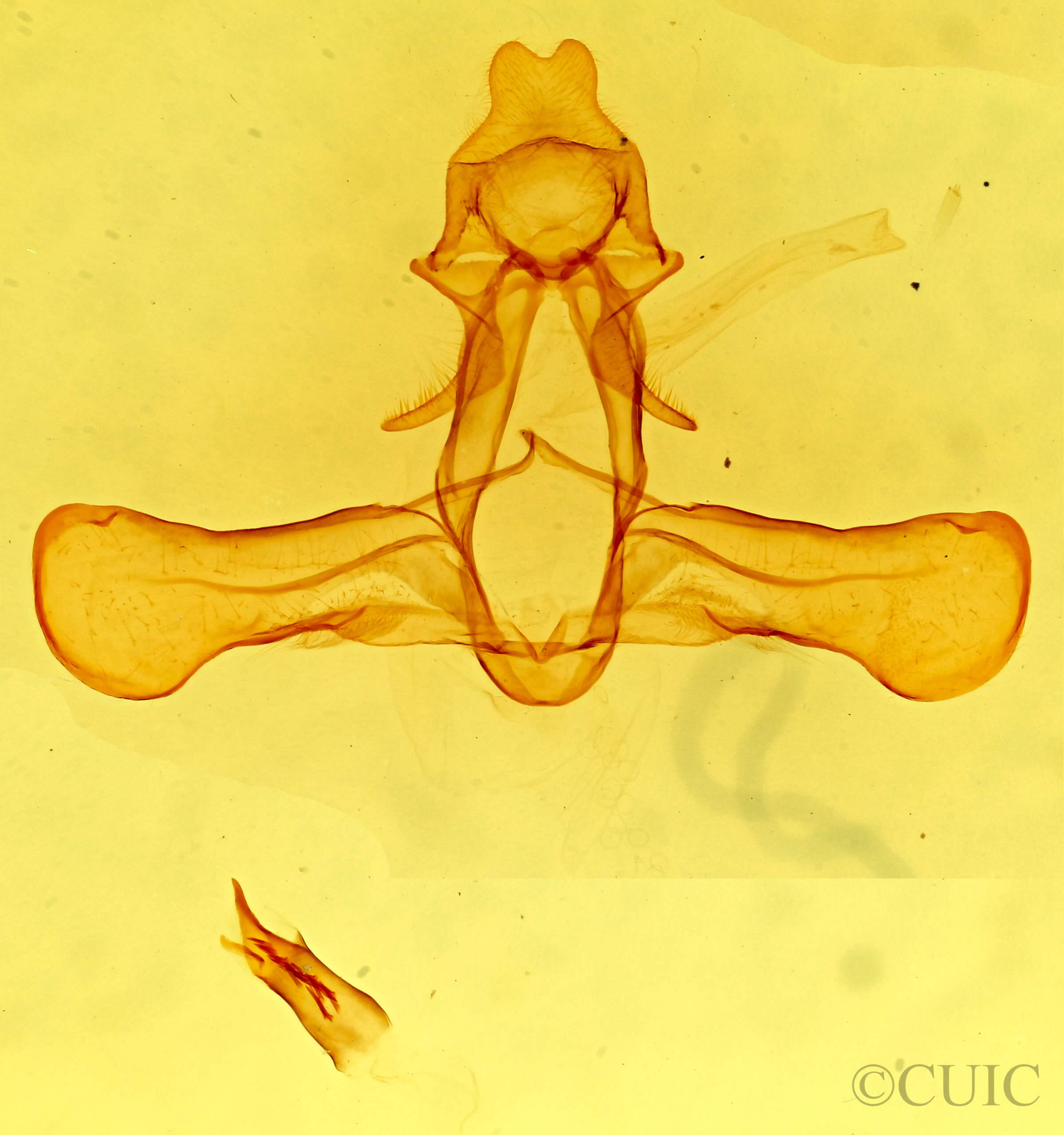 genitalia view of adult Phryganidia californica