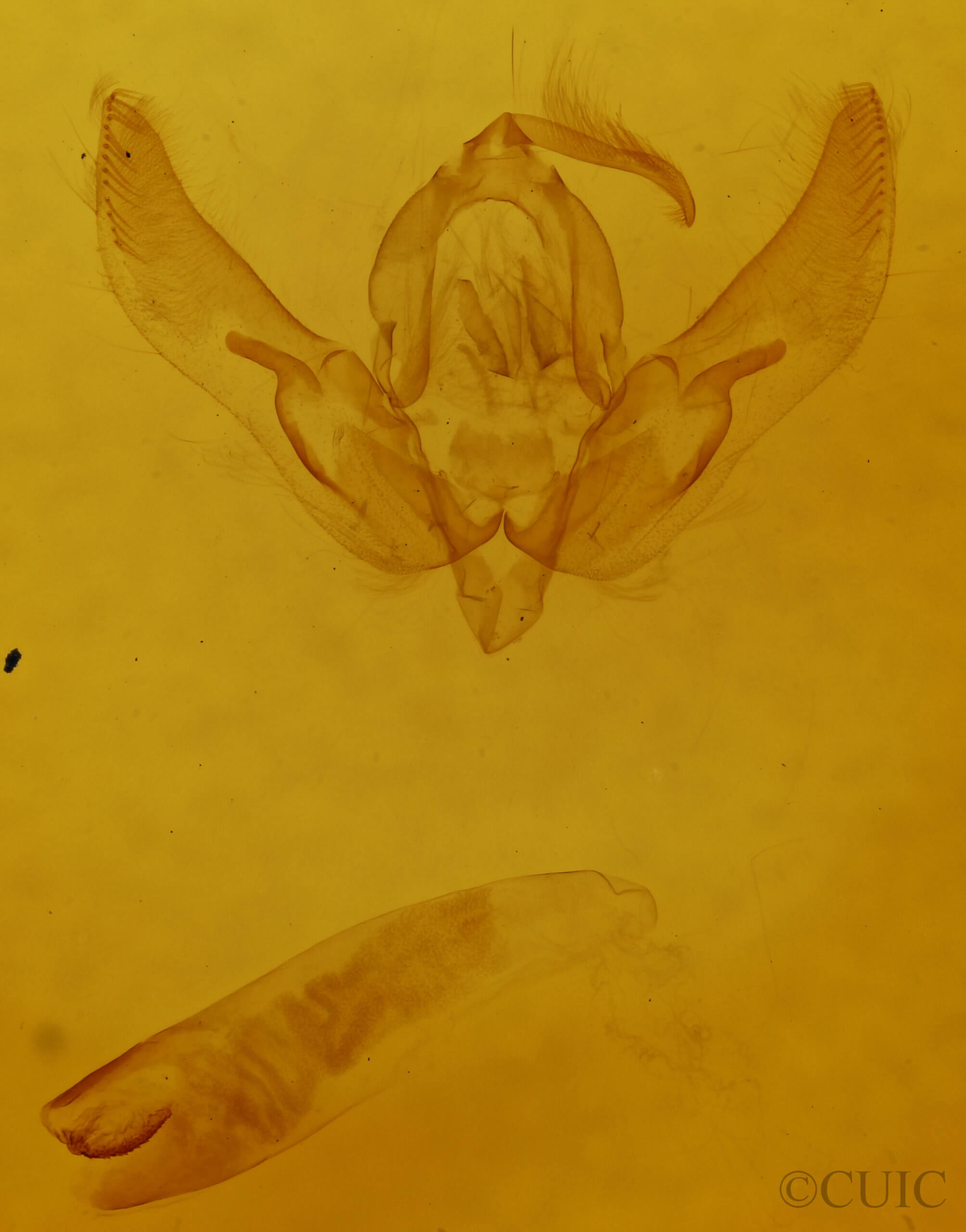 genitalia view of adult Agrotis