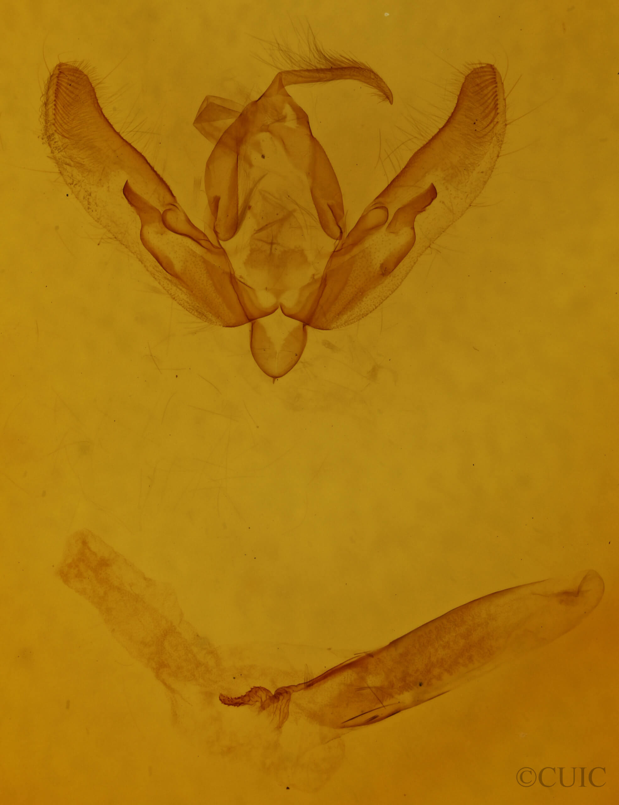 genitalia view of adult Agrotis