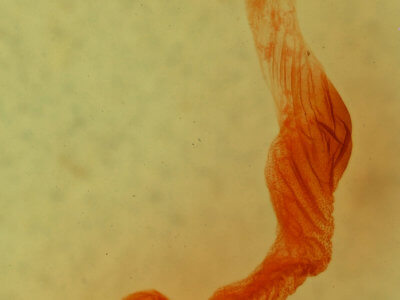 genitalia view of adult Anicla infecta