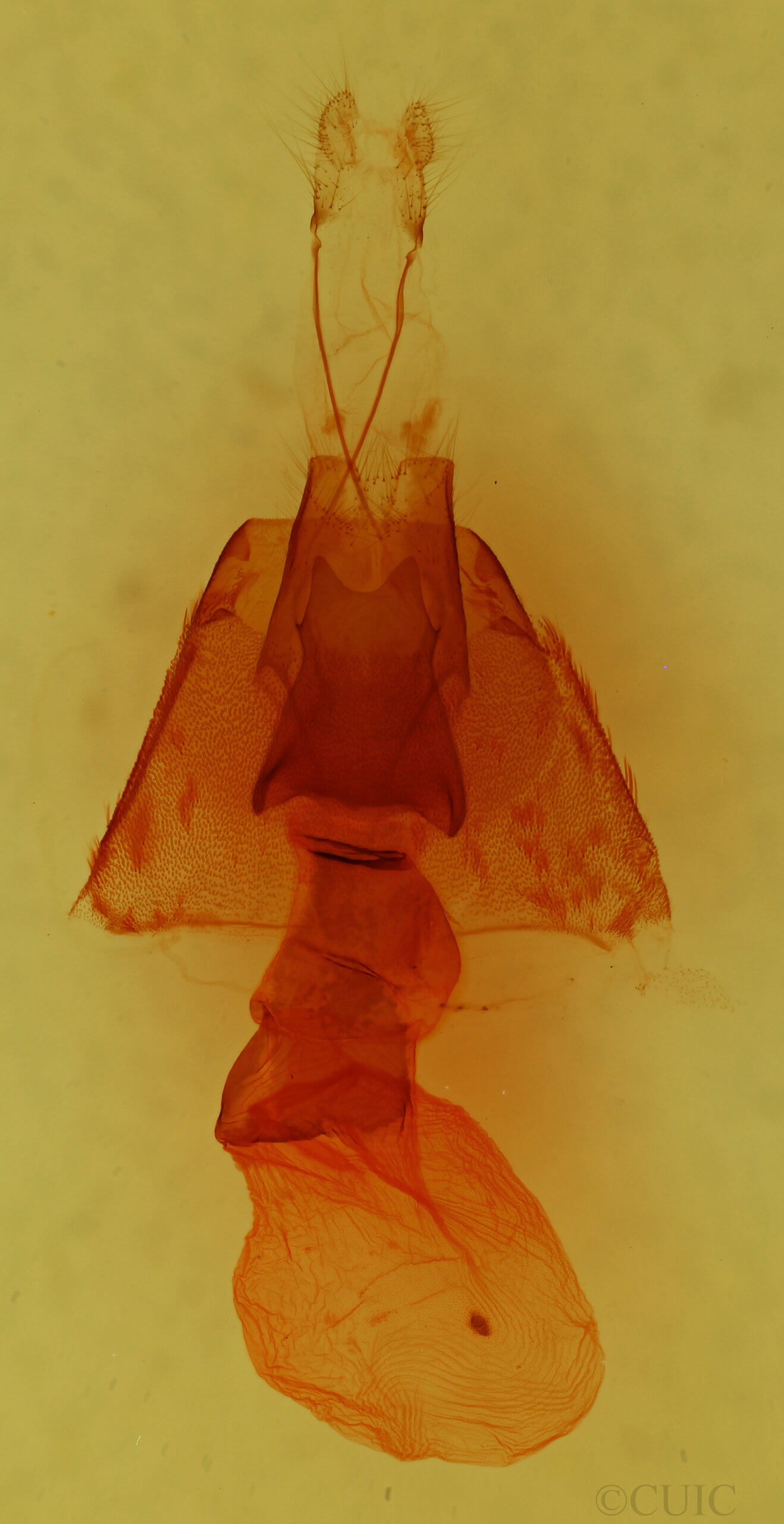 genitalia view of adult Anorthodes triquetra